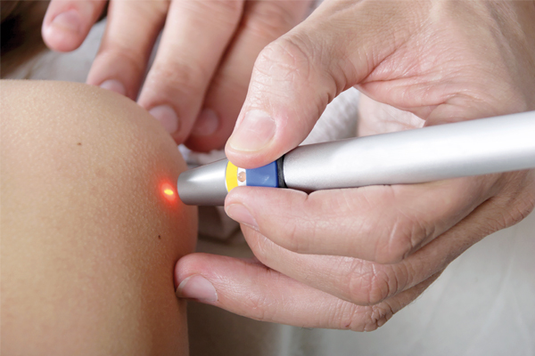 Capillari dilatati, inestetismi e macchie della pelle: la laserterapia KTP come soluzione definitiva