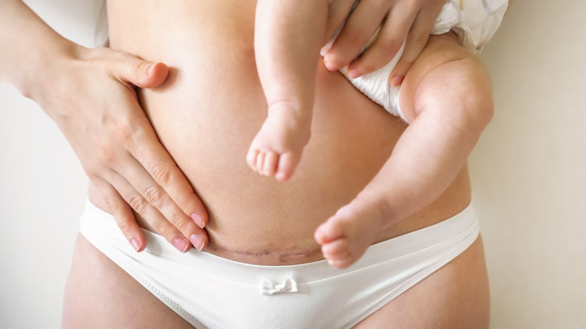 Medicina estetica gravidanza