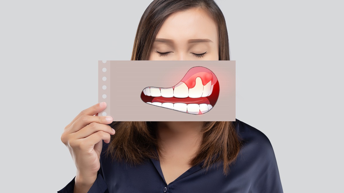 Che cos’è l’ascesso dentale e come intervenire