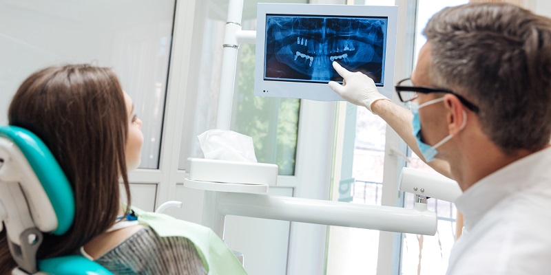 Impianti zigomatici in 3D per la chirurgia dentale