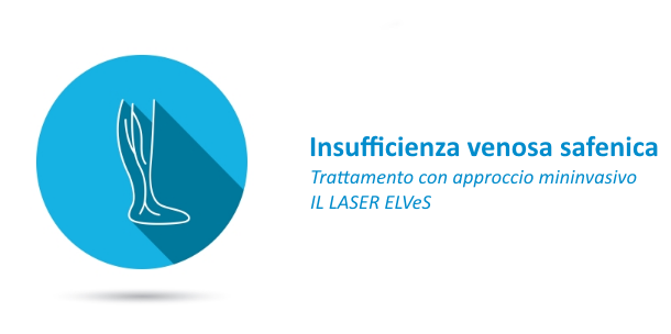 Insufficienza venosa safenica: trattamento con laser endovascolare (ELVeS)