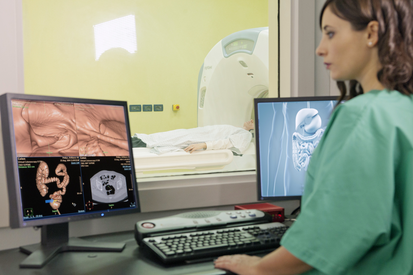 Colonscopia virtuale a Primus Forlì Medical Center per una diagnosi precoce e non invasiva 