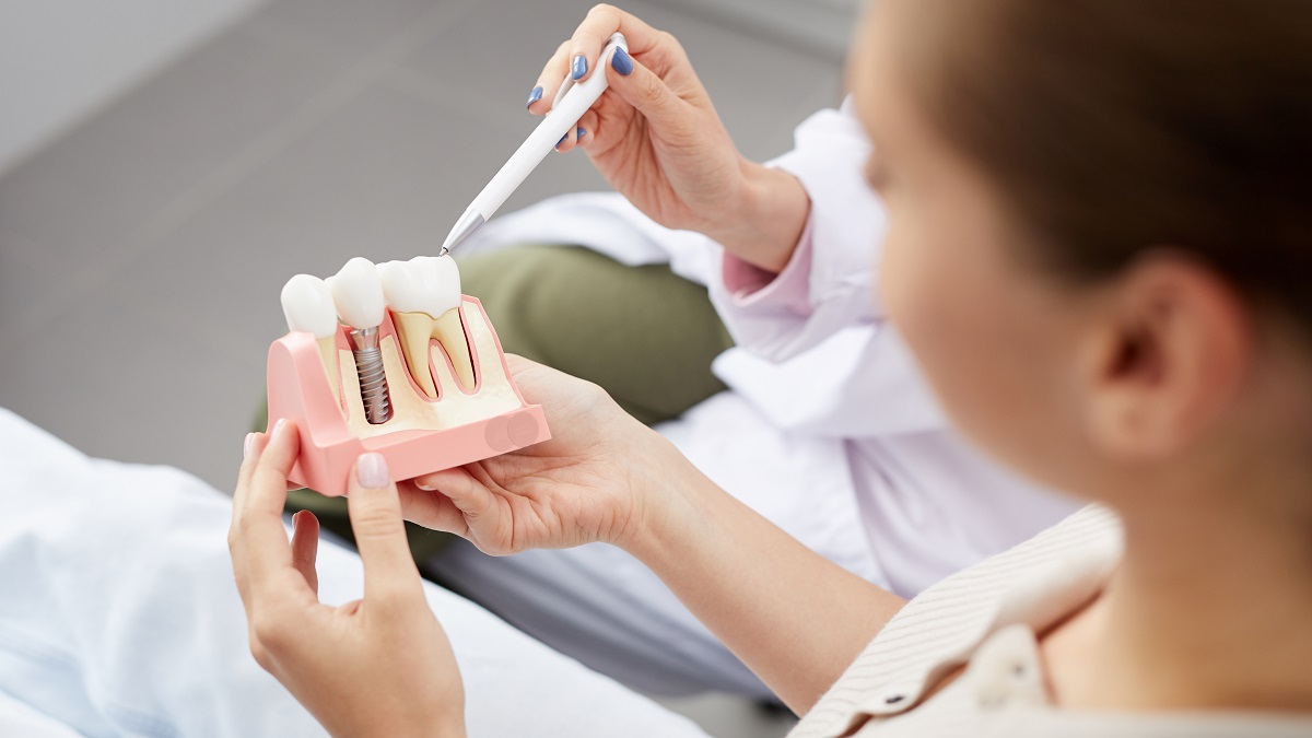 Implantologia e approccio conservativo:  salvare il dente o mettere un impianto?