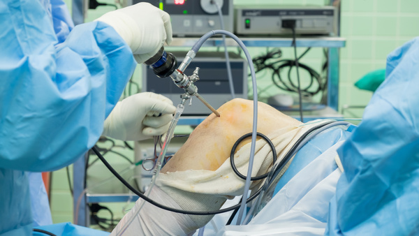 Le innovazioni in Artroscopia – materiali e tecniche chirurgiche