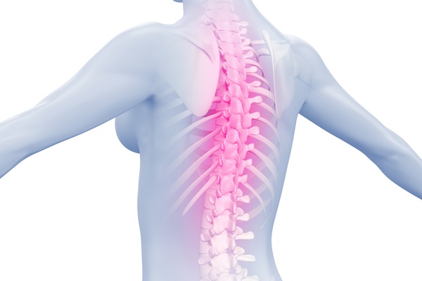 Crolli e fratture vertebrali? Arriva la vertebroplastica percutanea