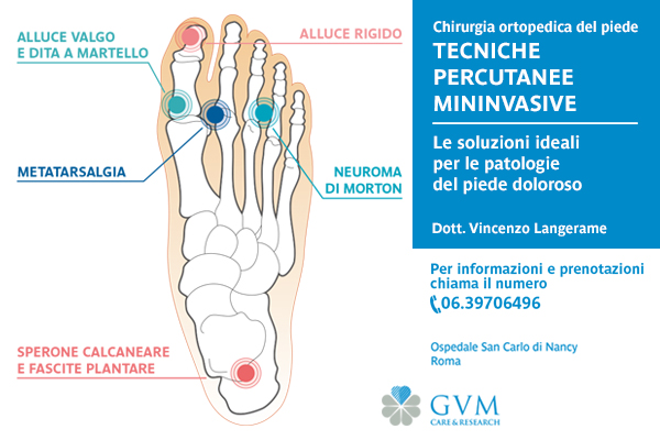 Dott. Langerame: le tecniche percutanee mininvasive per le patologie del piede