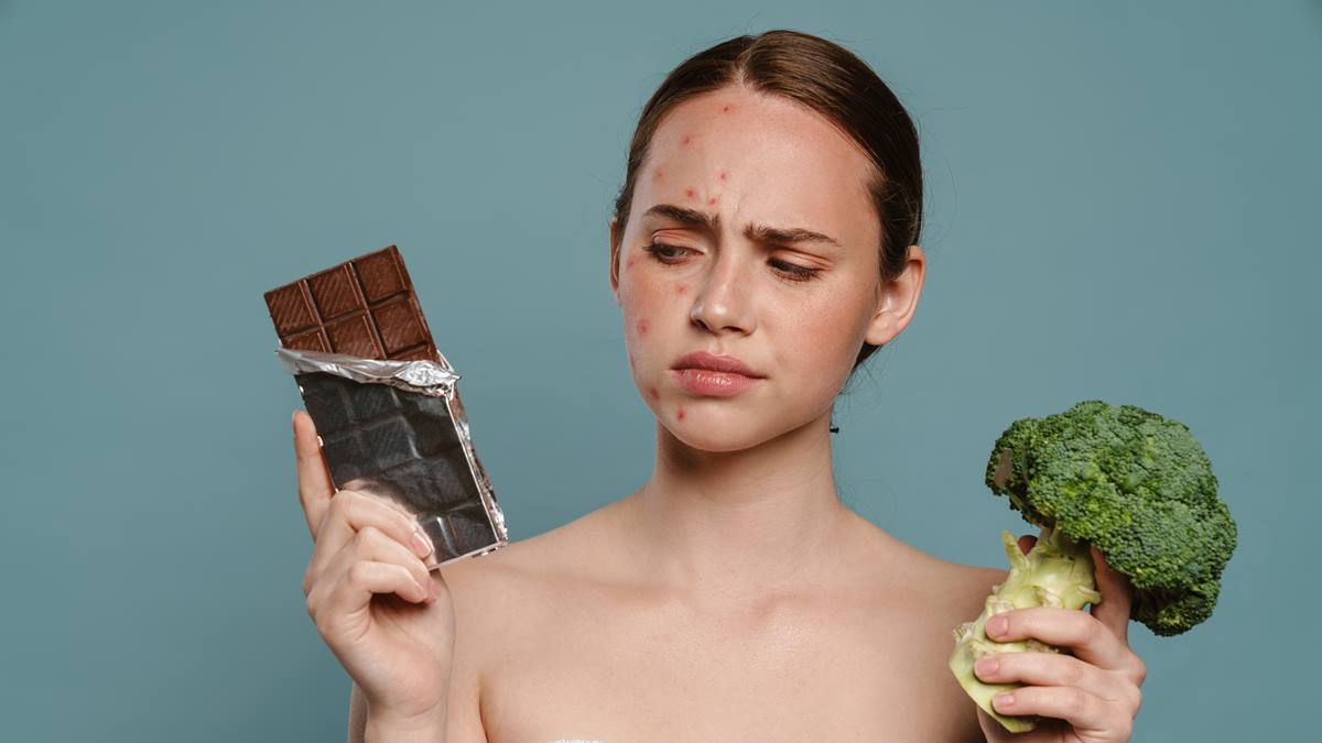 Combattere l’acne con l’alimentazione: quali sono i cibi da evitare?