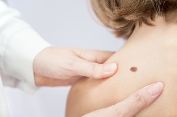 Prevenzione dermatologica: Check-Up il 18 e il 25 gennaio