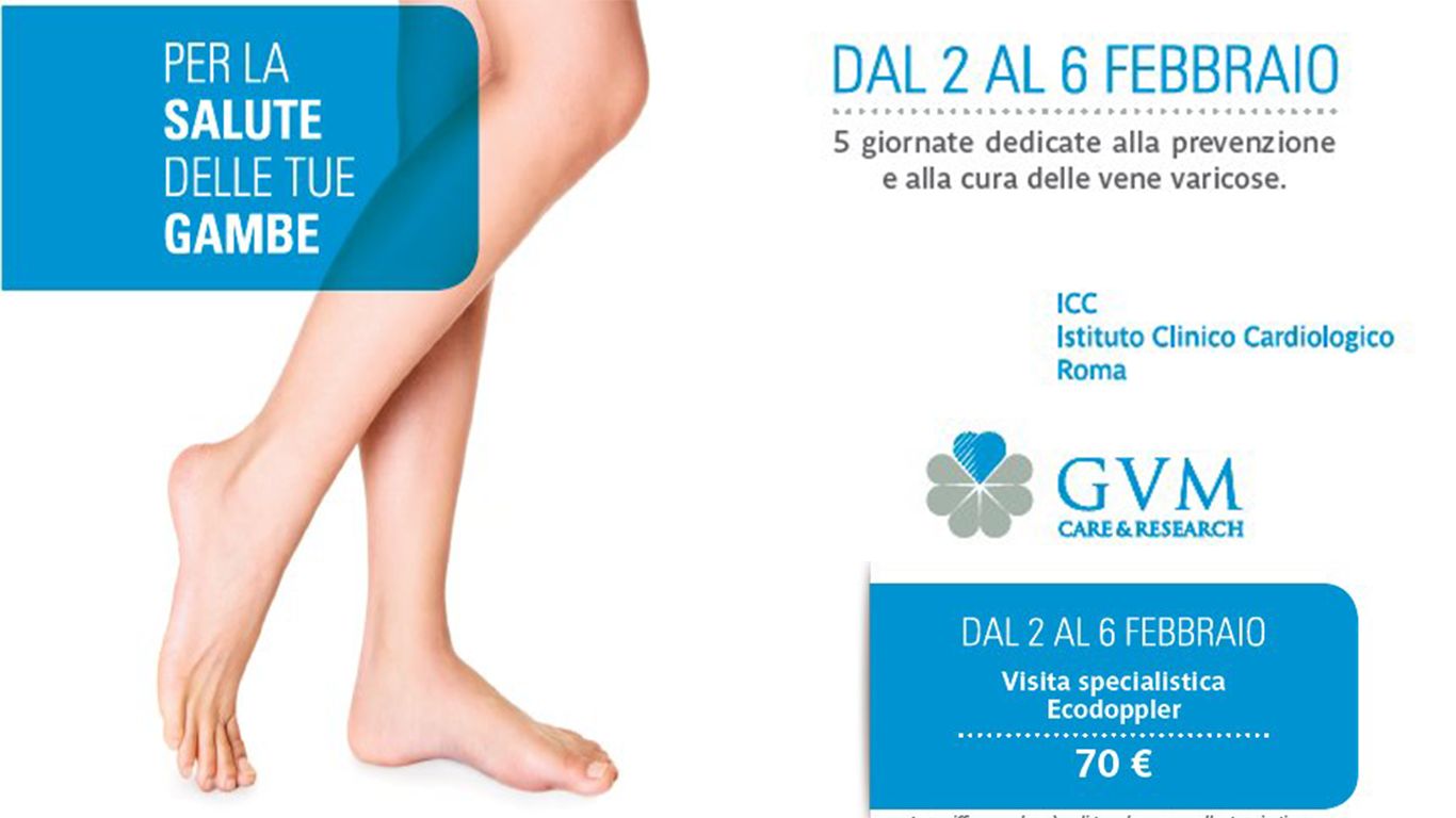 Prevenzione vene varicose: check-up specialistico a ICC Roma 